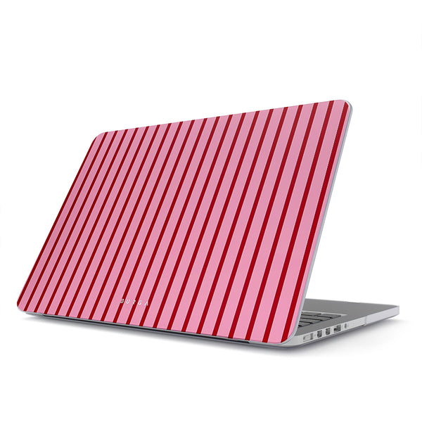 Favorite Bikini - MacBook Coque Rigide Macbook